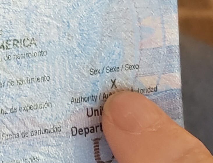 abd-de-intersekslerin-pasaport-zaferi-1